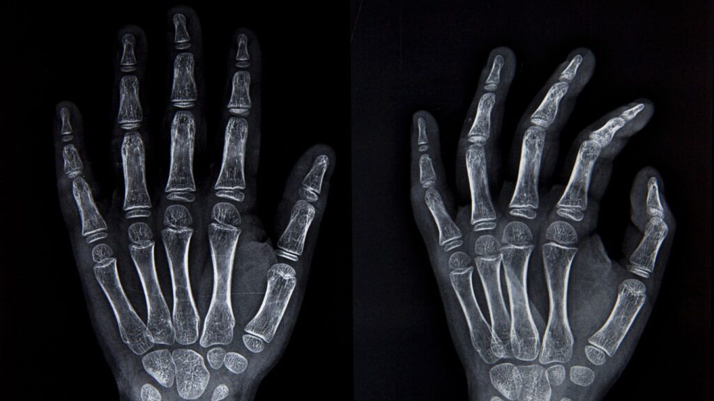 Radiografías en Querétaro