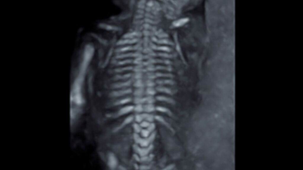 USG Estructural