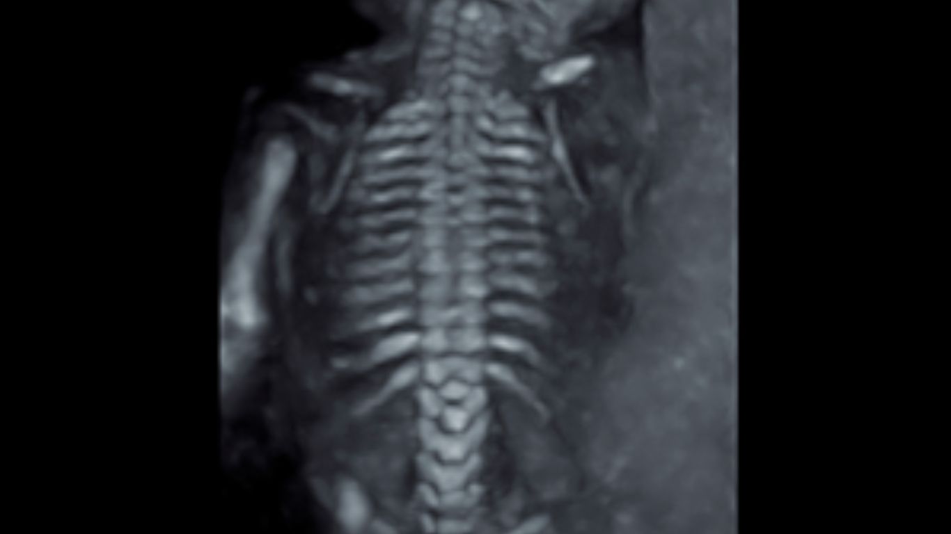 USG Estructural